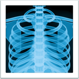 Radiographie Emoji U+1FA7B Radiographie Emoji U+1FA7B